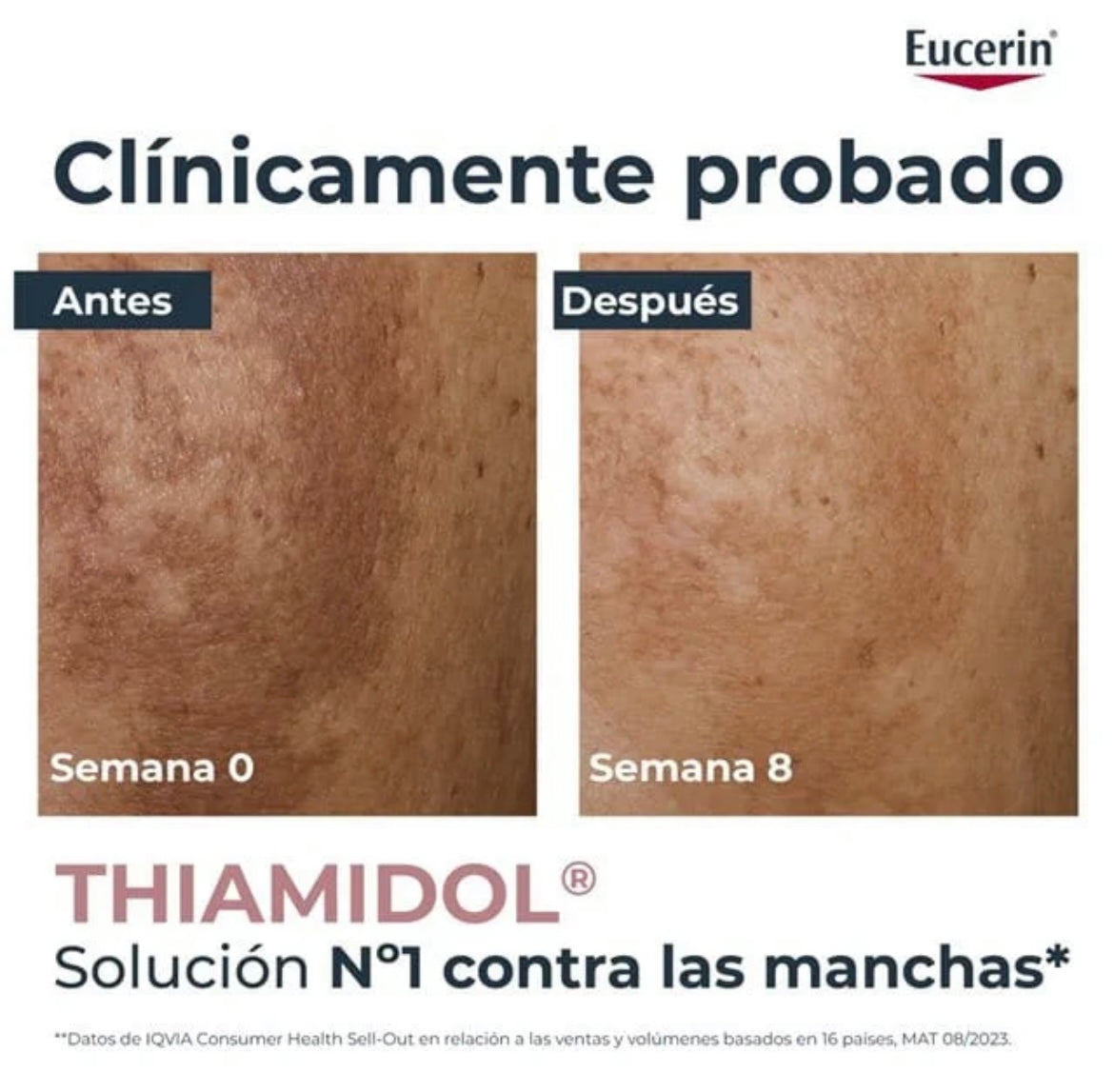 EUCERIN ANTI PIGMENT ULTRA LIGHT SERUM