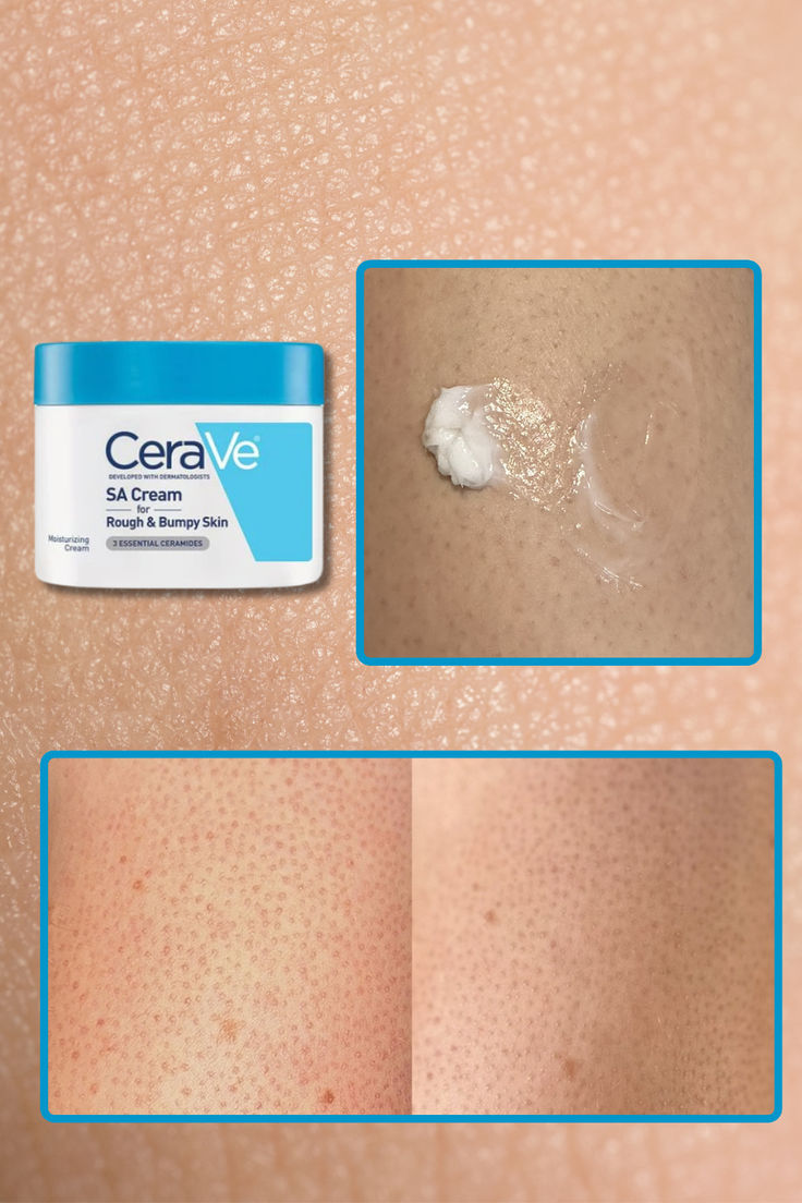 CERAVE SA SMOOTHING CREAM