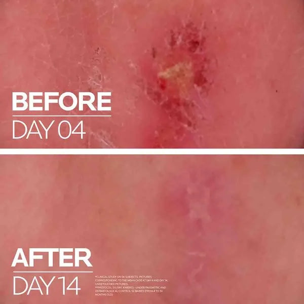 LA ROCHE POSAY CICAPLAST BAUME B5+