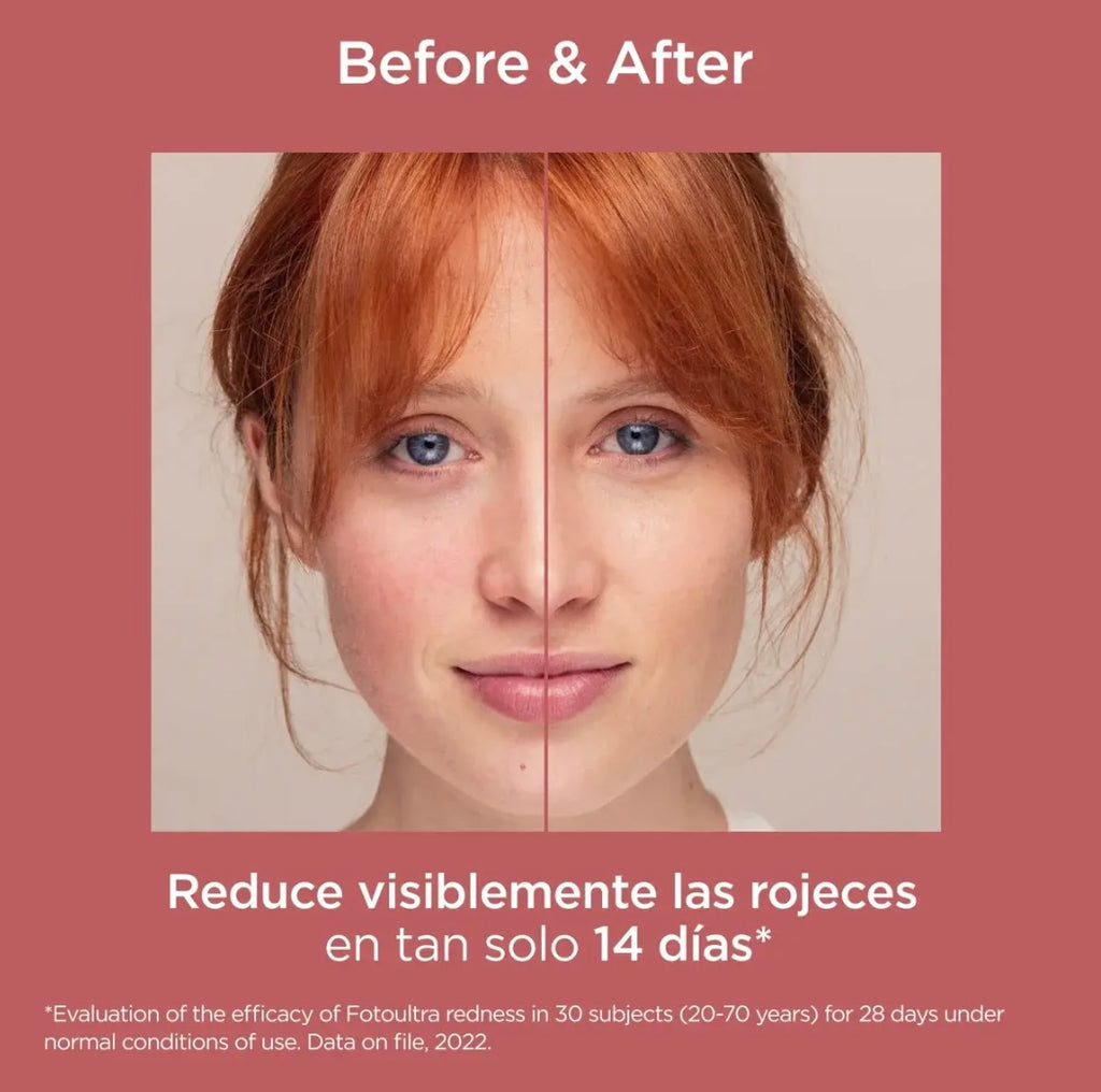 ISDIN FOTOULTRA REDNESS SPF 50